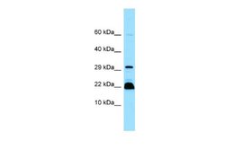 Fast skeletal myosin light chain 2 Rabbit anti-Human, Polyclonal, Novus Biologicals 0.1 mL | Buy Online | Novus Biologicals | Fisher Scientific